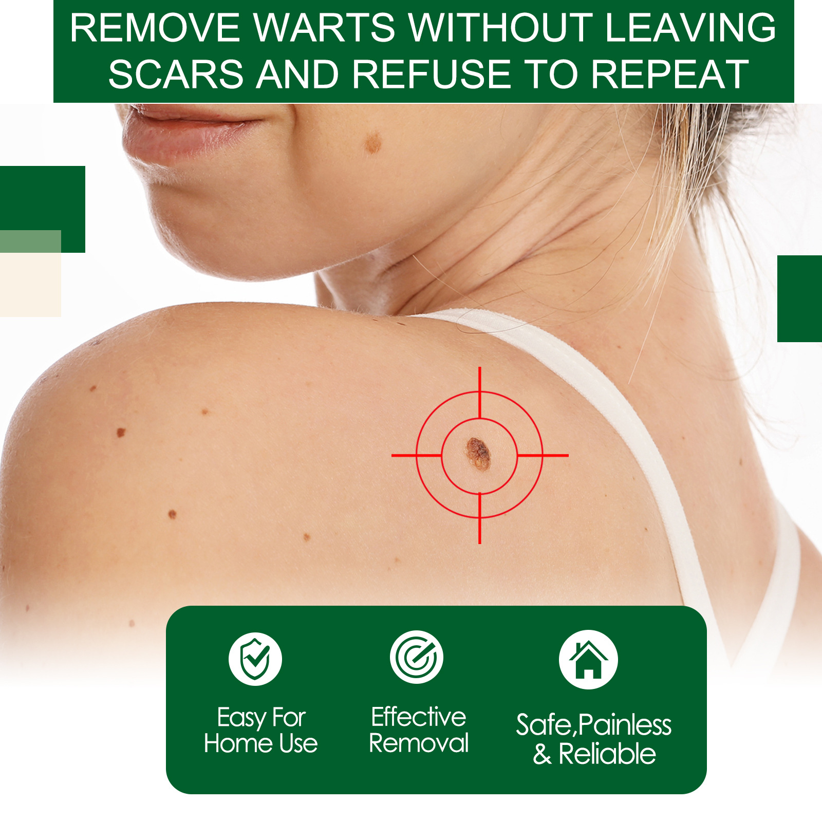 2024 wart remover to lighten flesh thorns, flat skin, especially corns, body warts, and filamentous warts_voghion.com