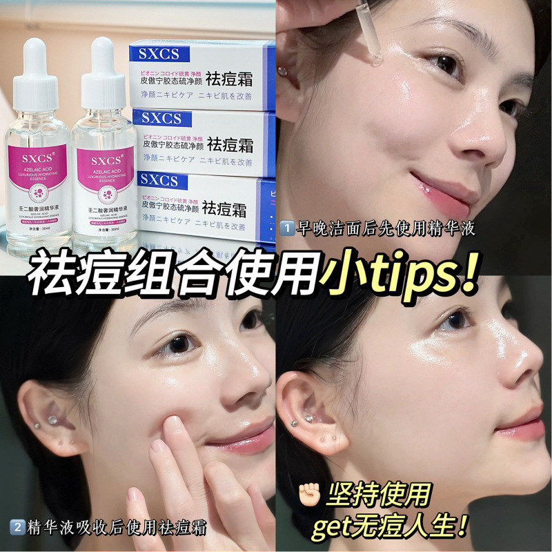 Su Xiuchen のアゼライン酸高級保湿エッセンス + Pi Aoning コロイド硫黄抗ニキビクリームは、くすみを改善し、ニキビ跡を軽減します|undefined