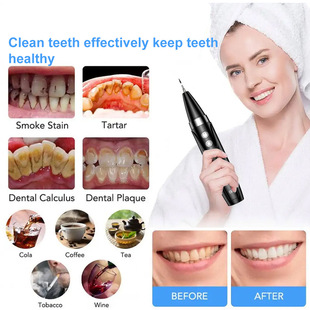 Oral Cleaner Teeth Cleaning Tooth Stone Yellow Plaque Remover for Teeth Visual Dental Cleaner