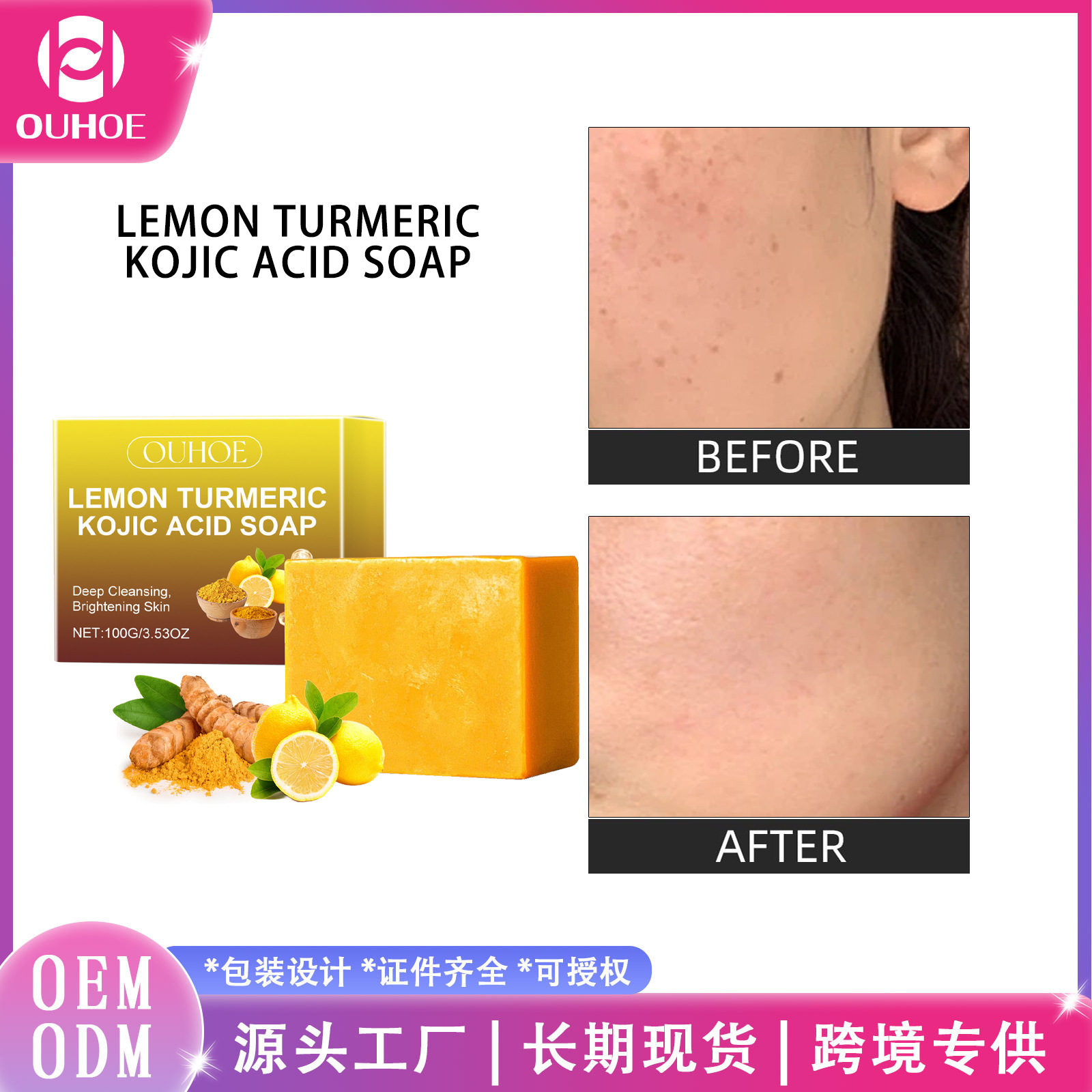 Ouhoe Lemon Turmeric Kojic Acid Soap Mild, Refreshing, Radiant, Clarifying, Softening, Moisturizing Bath and Face Soap