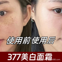 377������˪���ȥ�ߺڰ�ȥ�SƤ�S�ְ�ɫ���c�ӡȥ����