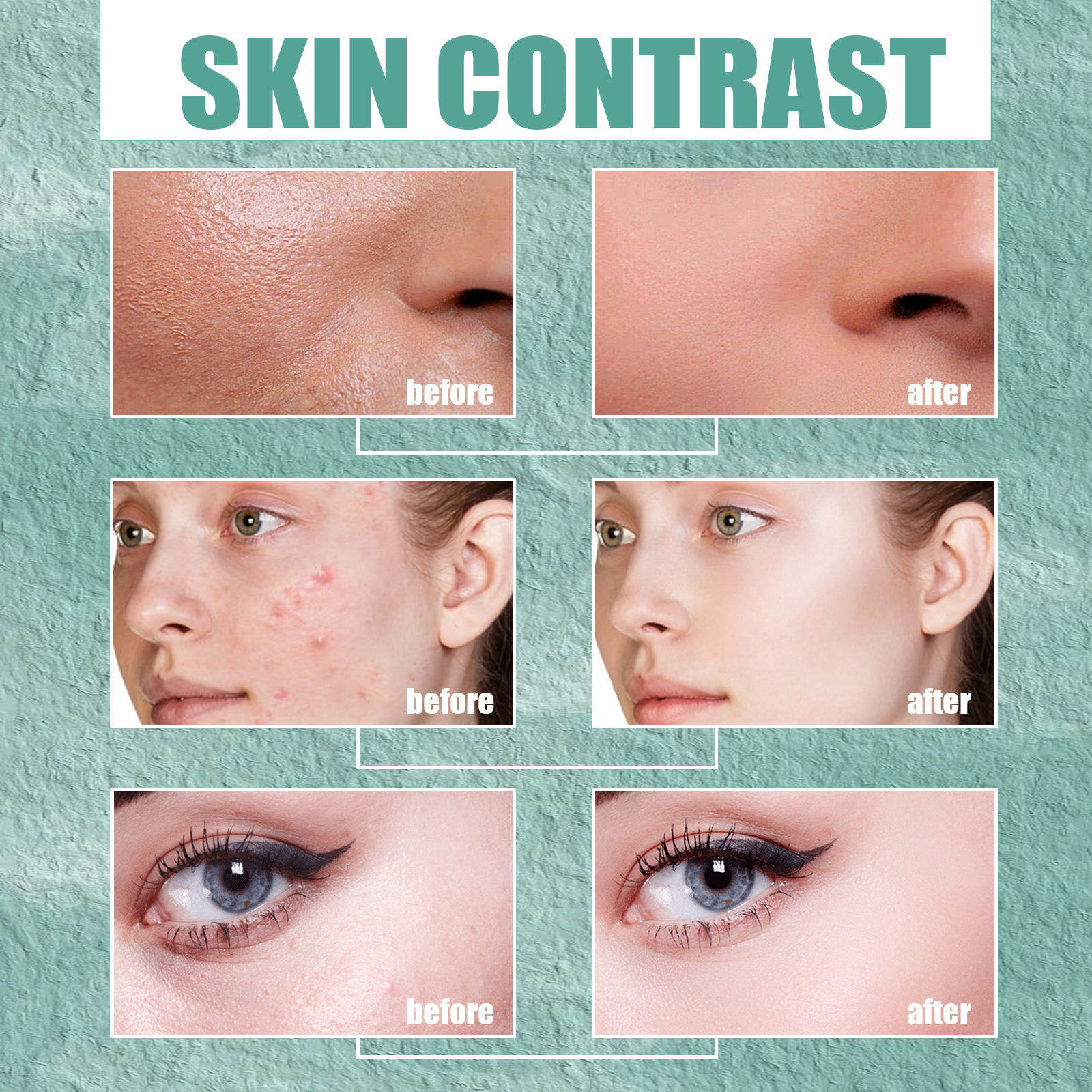 Jaysuing Kwas salicylowy Cystic do usuwania, zamykania, kremu naprawczego do twarzy z odciskami trądziku_voghion.com