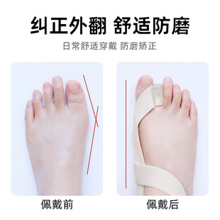 New Cross-Border Adjustable Thumb Tension Belt Toe Separator Strap Sebs Elastic Anti-Wear