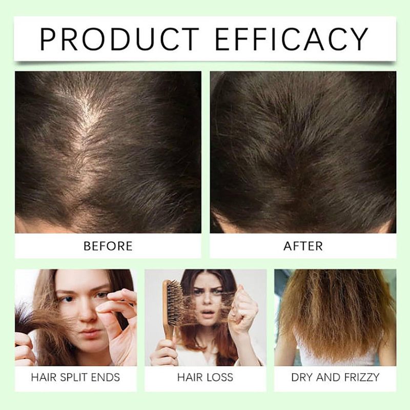 REMIMPI anti- Hair Fall Hair Loss Shampooシャンプーは髪を促進します|undefined