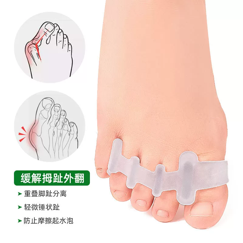 拇趾外翻矫正器 sebs脚趾分离器 四孔分趾器 男女夹脚 减震缓压