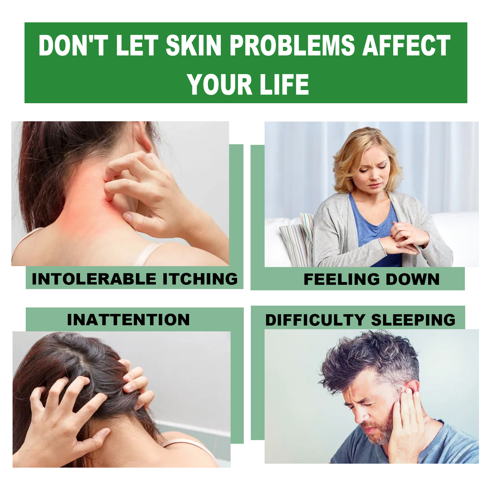 South Moon Anti-Itching Ointment for Wet Blisters, Relieves Itching, Sweat Blisters, Feishizhen Prickly Heat External Ointment_voghion.com