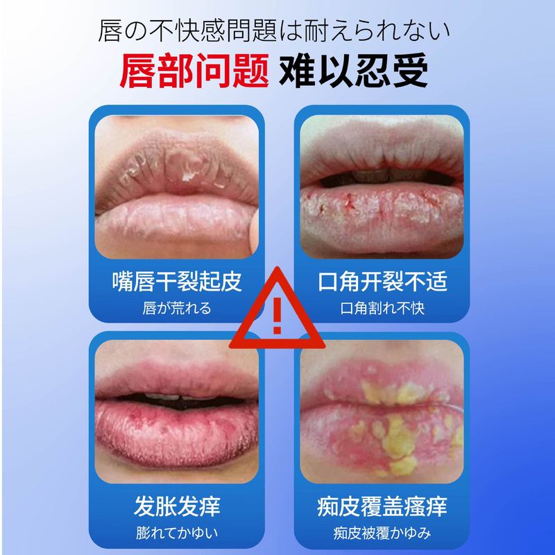 仓井奥科唇炎润唇膏唇部干裂起皮唇炎脱皮口角开裂护理保健膏跨境|undefined