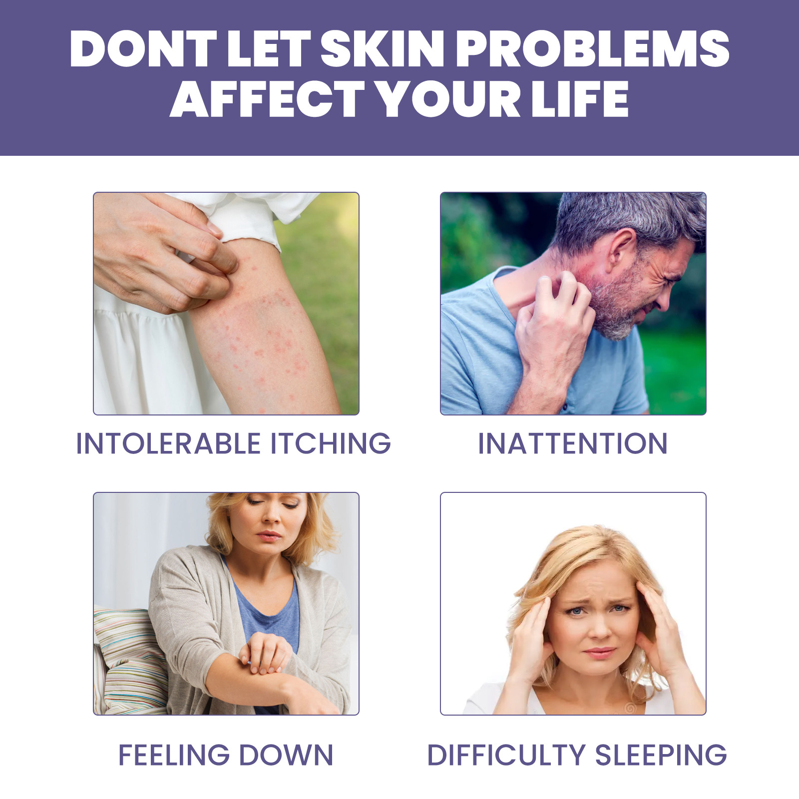 South Moon Skin Repair Cream herstelt de moshuidbarrière, verlicht roodheid en jeuk, hydraterende huidcrème_voghion.com