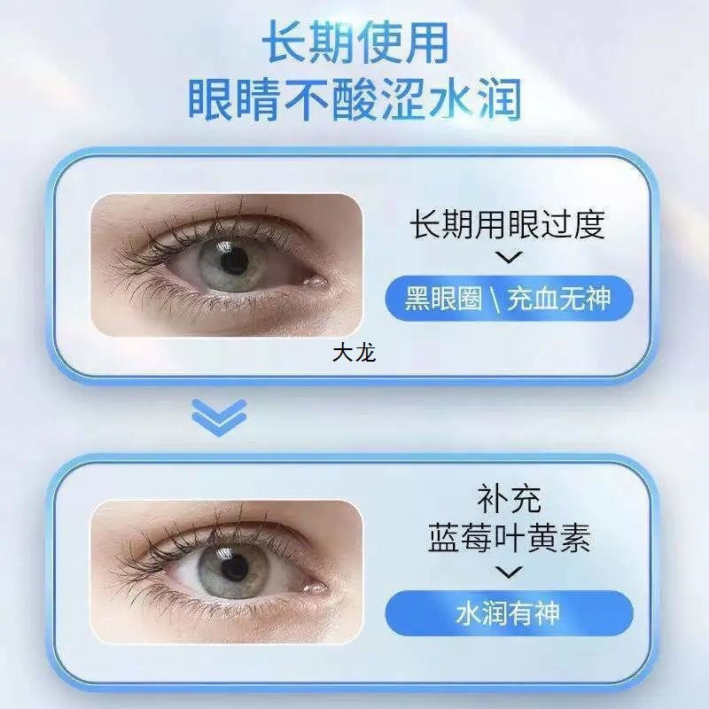 眼睛护眼发黄黄斑模糊飞蚊中老年蓝莓叶黄素日本进口60脂片|undefined