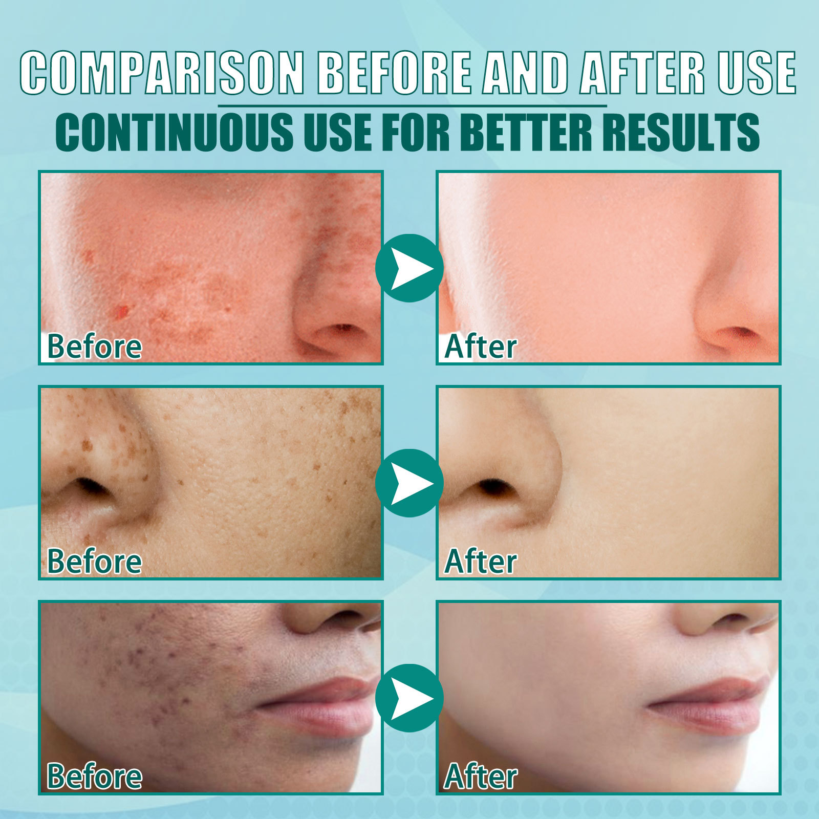 South Moon brightening and lightening spot cream. Lightening of spots, freckles and chloasma. Brightening and rejuvenating moisturizing cream._voghion.com