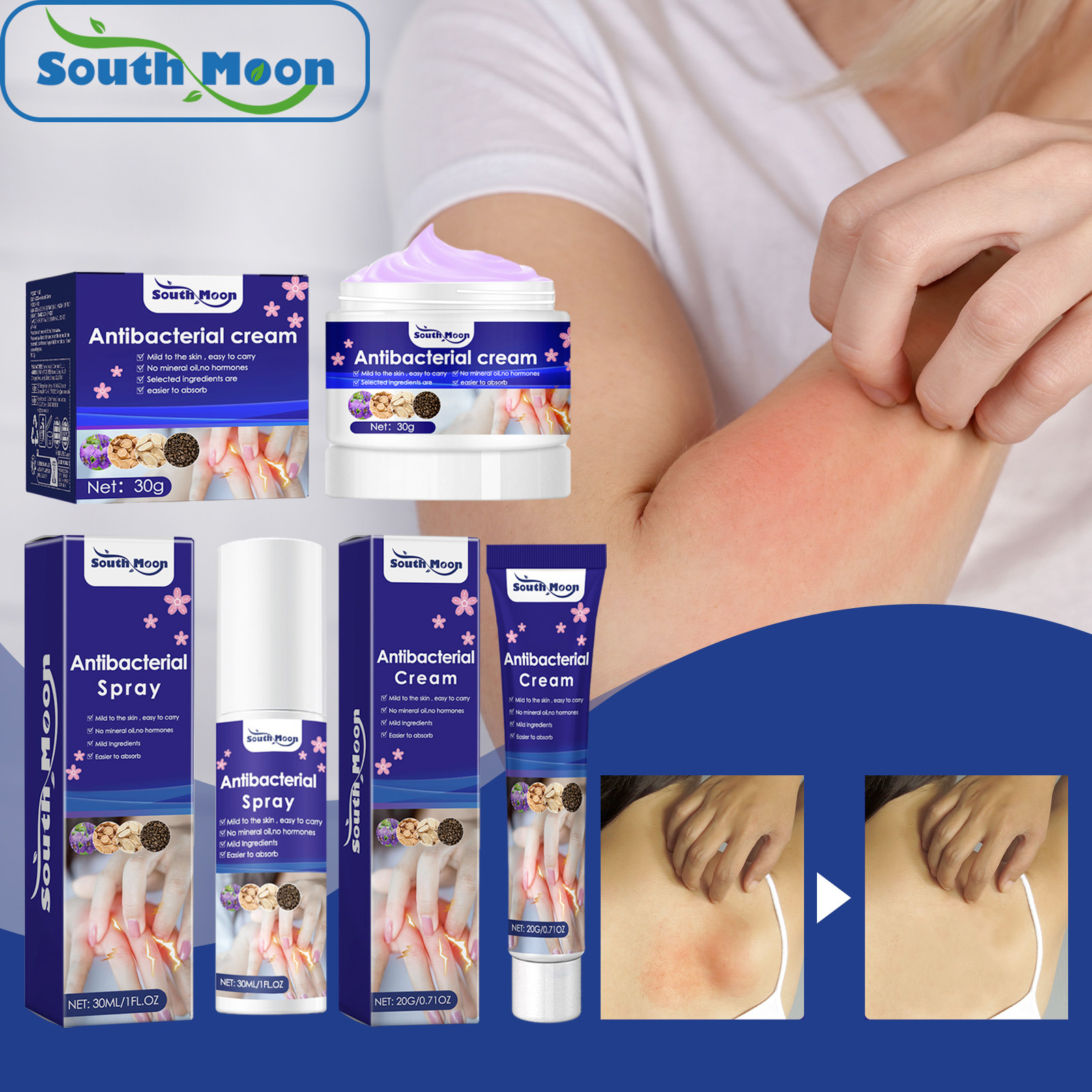South Moon Purple Flower Skin Care Spray Skin Redness Itching Mosquito Bite Care Spray