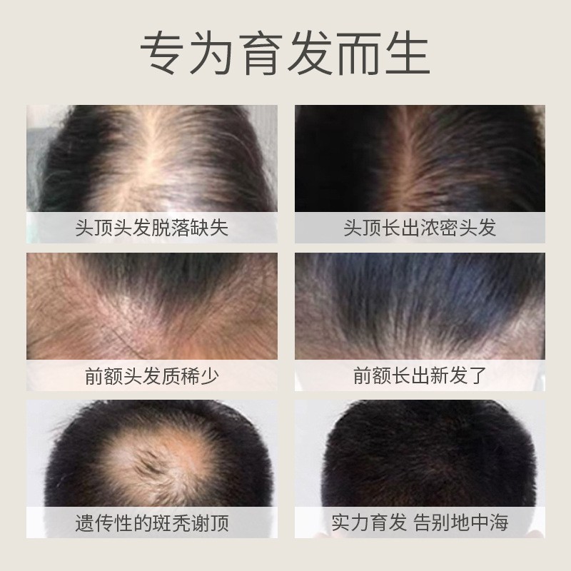 官方旗舰店乌发育发液  防脱育发缓解头发发际线稀少育发营养液剂|undefined