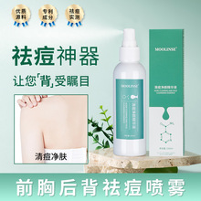 跨境祛痘精华喷雾面部美背清痘粉刺补水保湿嫩肤控油150ml大容量