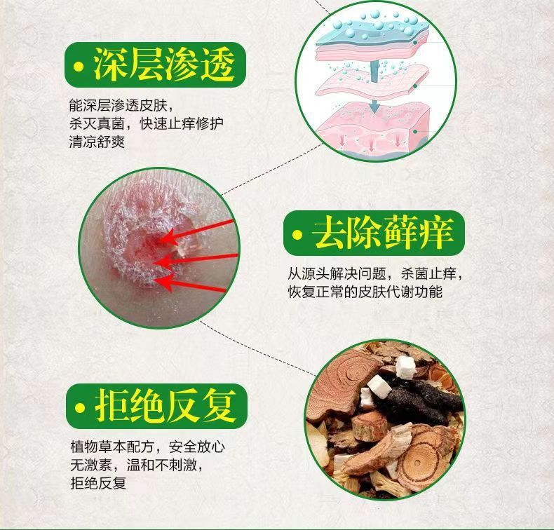 皮膚看護保健液今日の扁鵲は皮膚の濡れかゆみを緩和します。|undefined