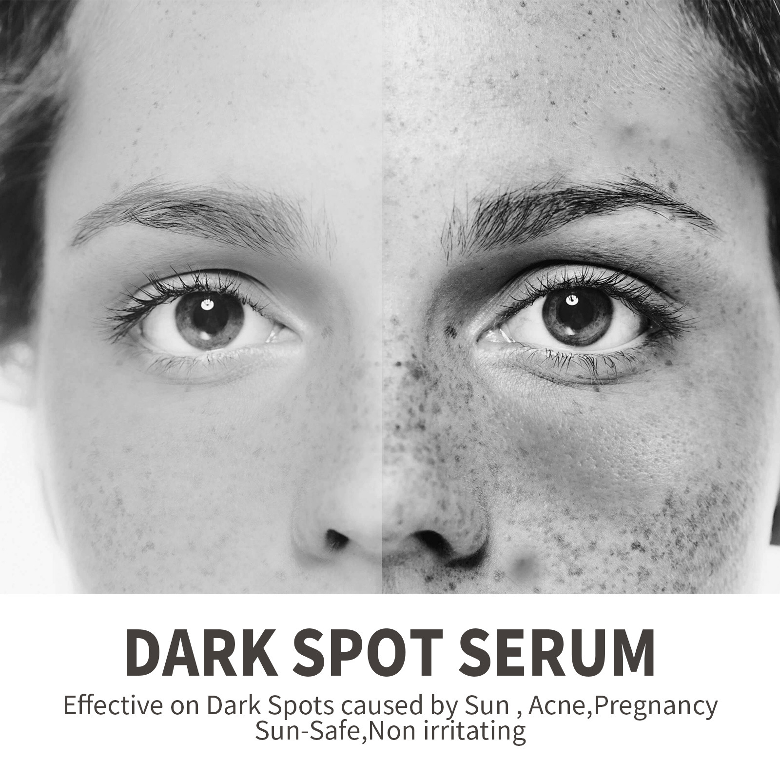 OUHOE Dark Spot&Acne för att bleka fläckar, återfukta huden, reparera aknemärken, mörka och ljusa upp ansiktets essens_voghion.com