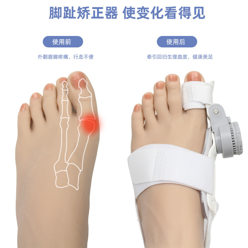 男性と女性用の新しい親指外反矯正整形外科用つま先セパレーター、夜間使用用のノブ付き調節可能なつま先分離矯正器|undefined
