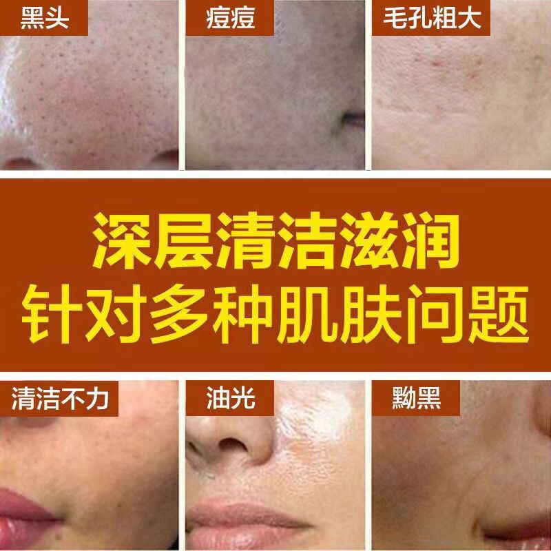 美容院は肌を明るくして、暗い黄色の黒色の色の代の卸売りに行きます。|undefined