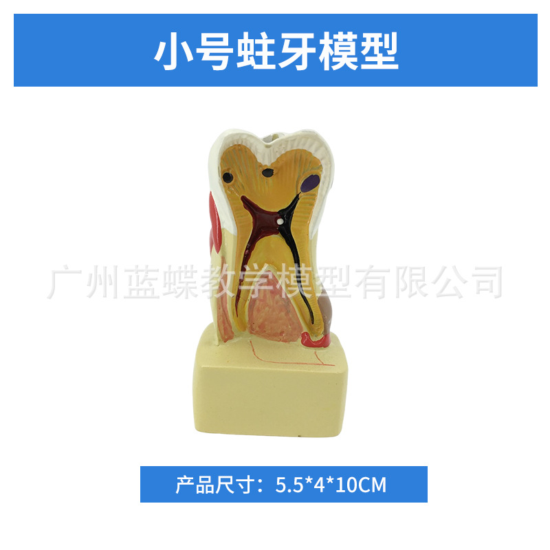 ���ƿ�ǻ�ı�ȣ�ݷֽ�ģ�� ����������ʾȣ�ݷ�չ���� ҽ����ͨ