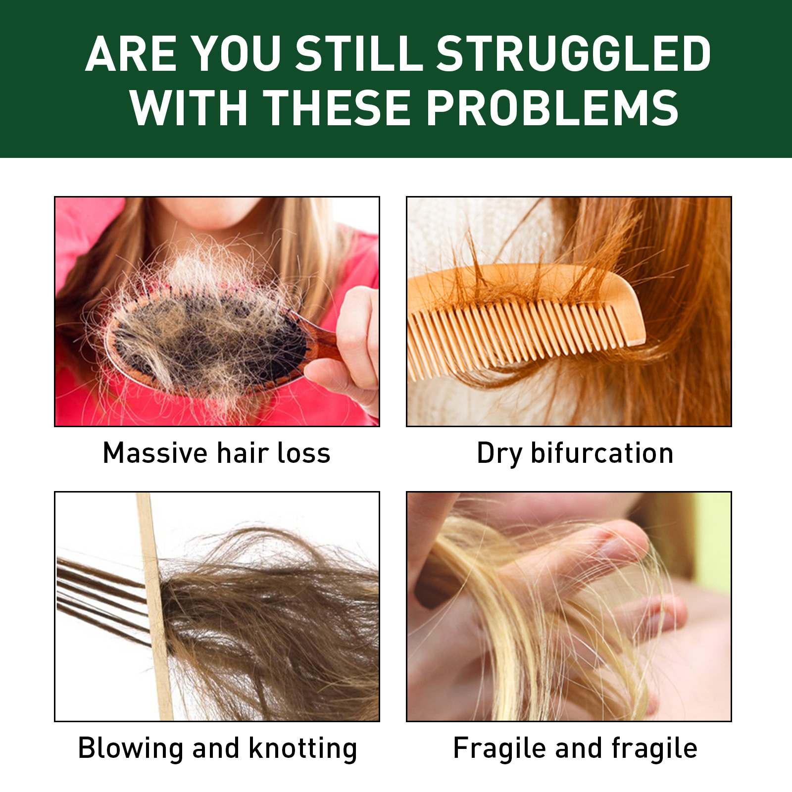 EELHOE Dichtes Spray, feuchtigkeitsspendend, festigend, juckend, kräftig, dick, ausfallsicher, nährend, weich und kompakt_voghion.com