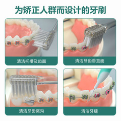 Orthodontic toothbrush household soft-bristled antibacterial silver ion orthodontic braces special concave cleaning portable