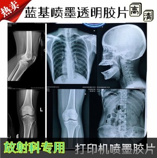 �t���zƬ��ī�{Ƭ�{����ʽ����ƴ�ӡ�zƬ���ƹ���X��Ƭ DR CR CT