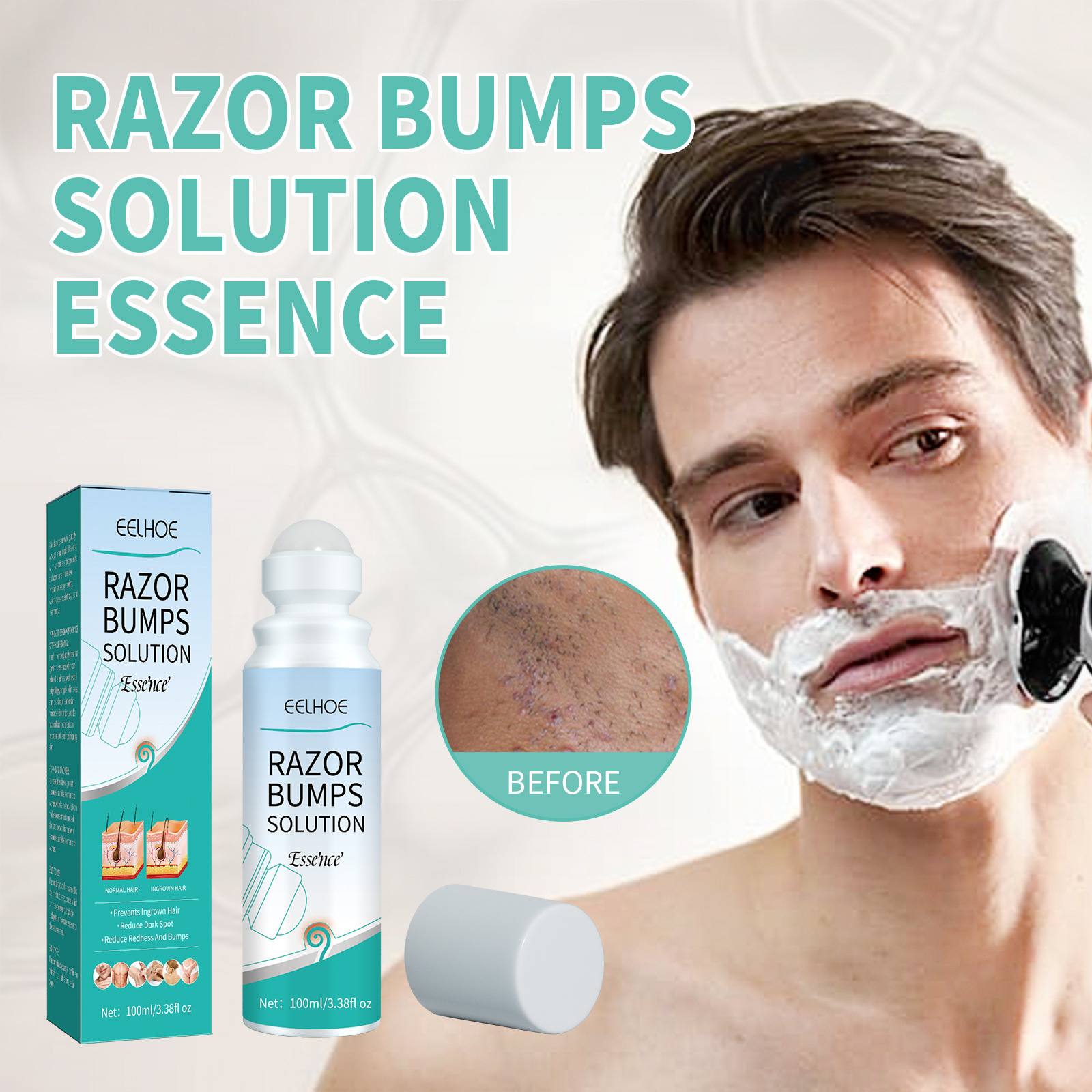 Bola de afeitar EELHOE para reparar los granos de la piel y evitar que el cabello crezca hacia adentro._voghion.com