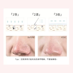 Summer Strawberry Patch, Gentle Blackhead Removal Nose Patch, Processing Agent, Pore Shrinking Export Liquid, Blackhead Patch Source Factory