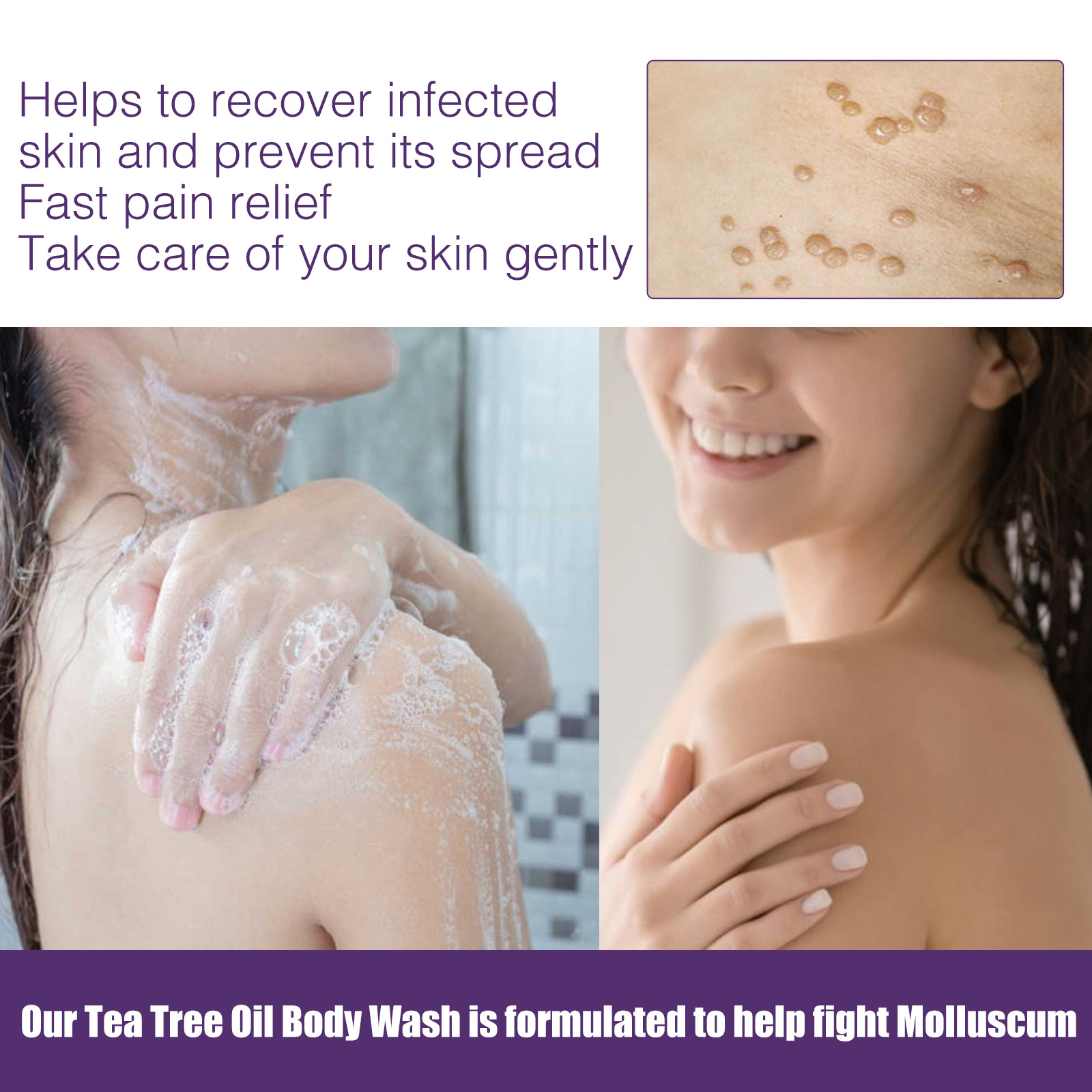 Skin Cleaning Removal of Underarm Hand and Foot Anti Wart Flat Care Liquid Set_voghion.com