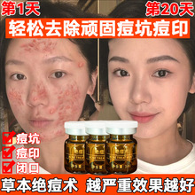 ����Ժ�^���g���ഺ�����]�ڷ۴̵�����ӡ�ޏͶ����沿����AҺ