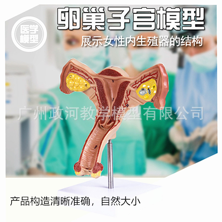 女性病理子宮模型 女性婦産子宮結構解剖 仿真病態子宮模型