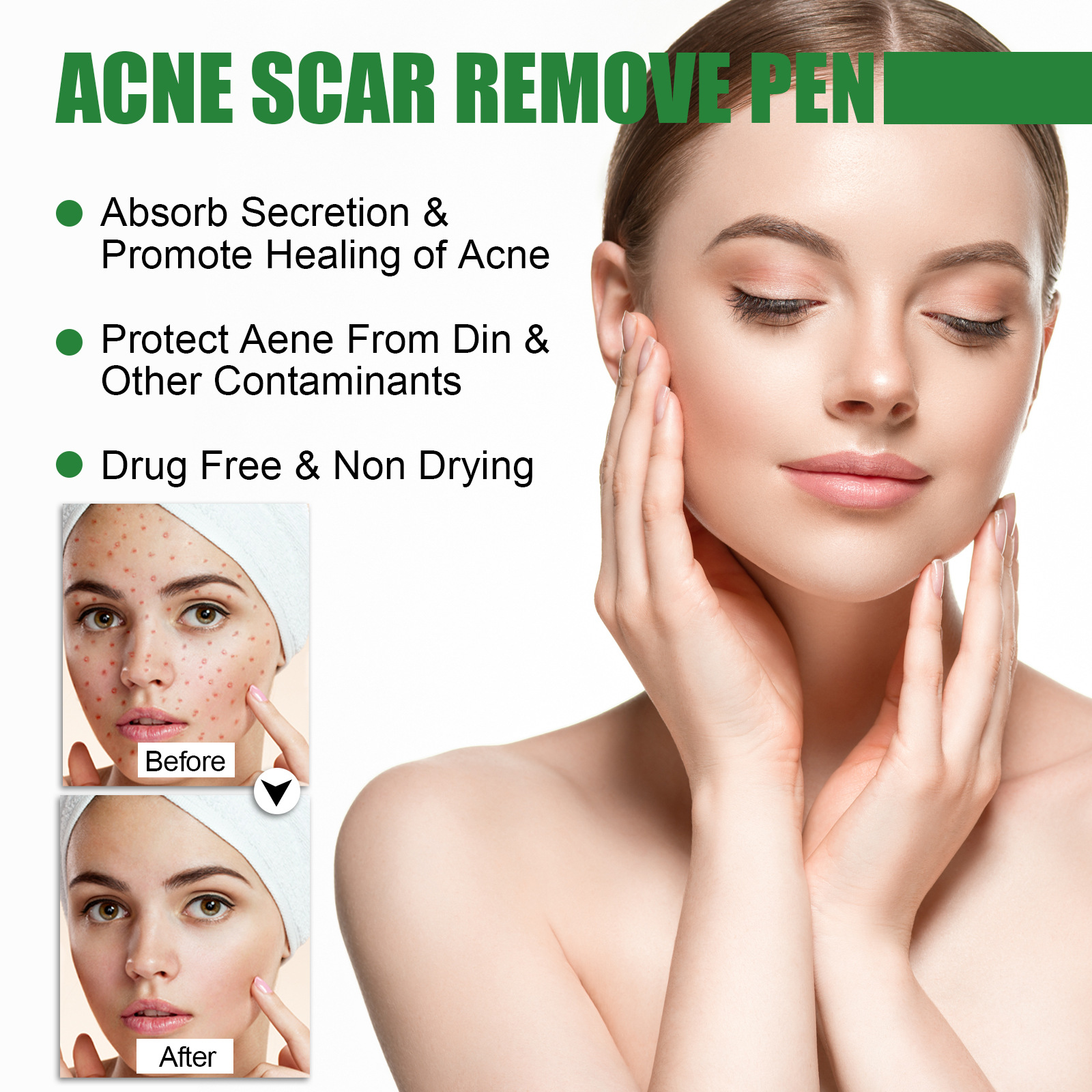 „EELHOE Ac Cleansing Pen“ valomasis pieštukas giliai valo odą, šviesina Ac randus ir atkuria užčiauptos burnos ertmės žaizdas._voghion.com