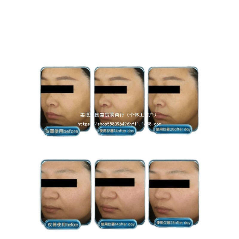 MESMOOTH慕苏美容仪脸部家用美容洁面法令提拉紧致按摩面部开学季|undefined