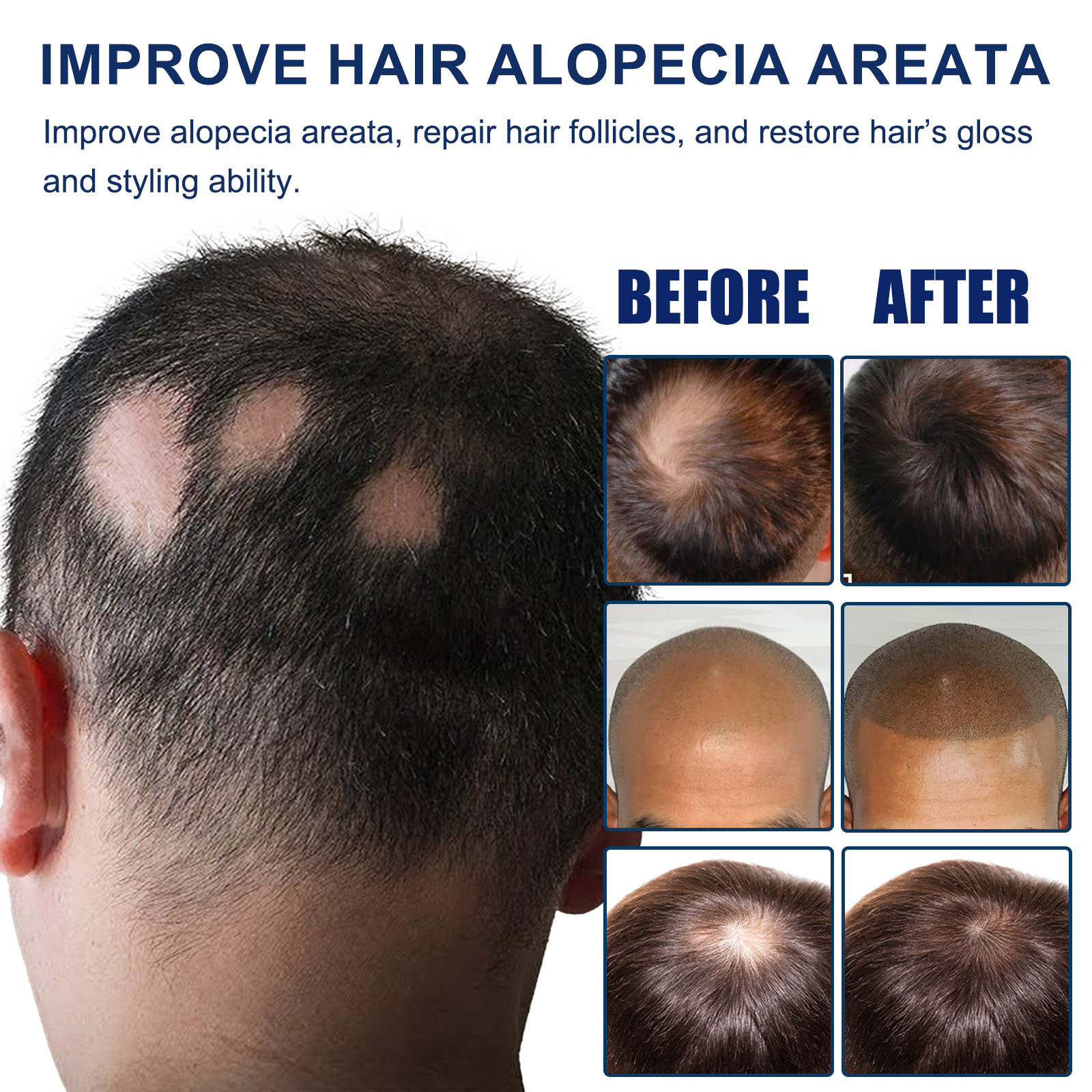 South Moon Hair Care Shampoo Smooth Hair Moisturizing Scalp Massage Care Shampoo