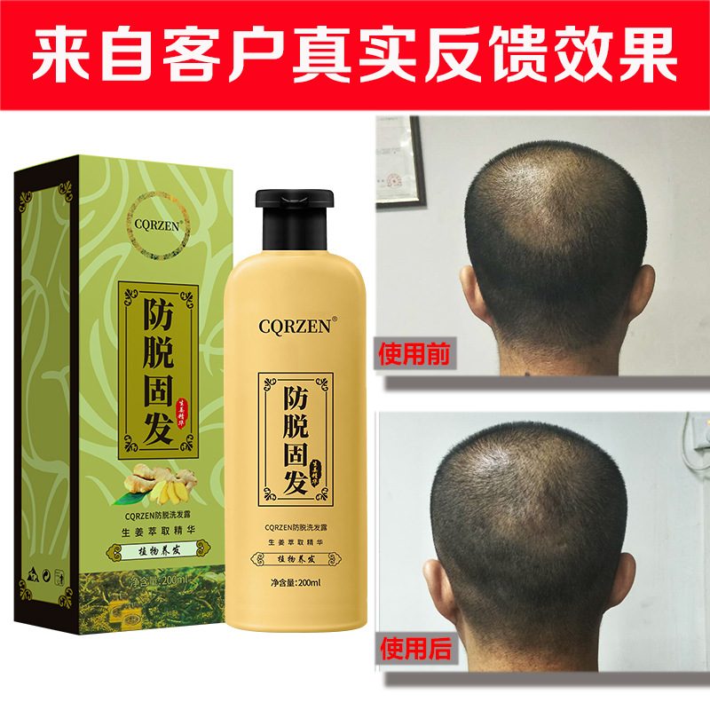 防脫洗髮水CQRZEN廣州洗髮水定量做廠家直銷何首烏O生薑EM洗髮露