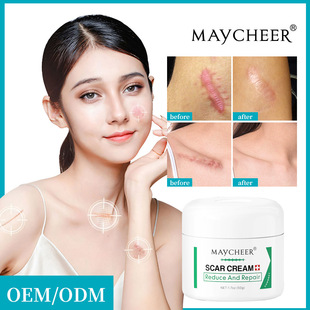 Maycheer Post-Burn Reduction Skin Ointment Cross-Border European, American, Middle East Export