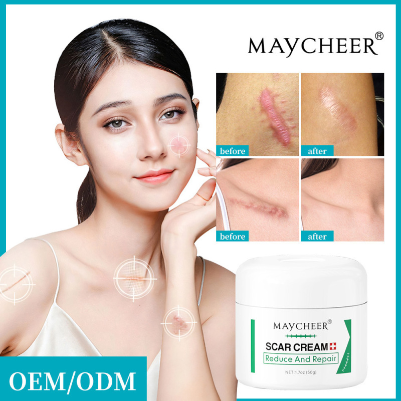 MAYCHEER 火傷後美白軟膏 欧米中東の越境貿易|undefined