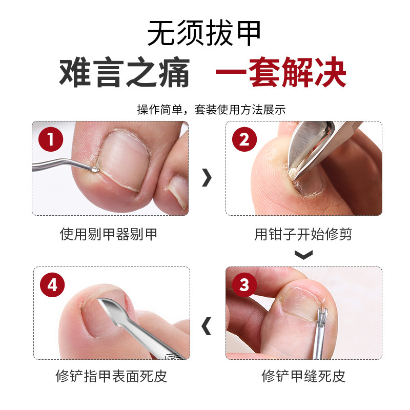 Nailcutter duro regalos de reparación gruesa gran generación de pinzas de garganta de uñas grises abertura conjunto de zanja de uñas cortadora de piel muerta boca plana