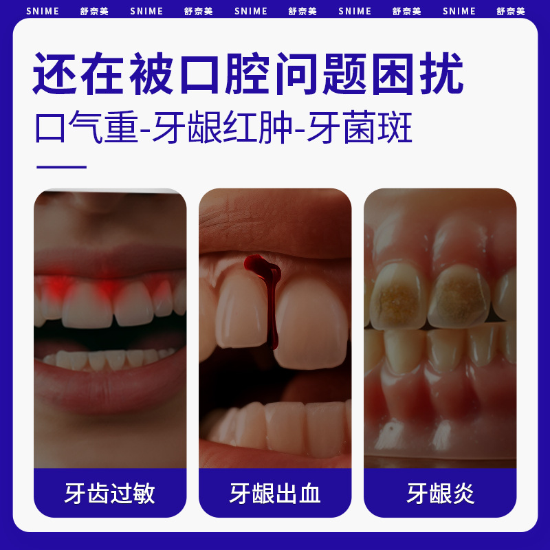 Crema de desensibilización dental médica Shunami Cuidado bucal Dientes Sensible Gingivitis Gingivitis Fina Pasta de dientes