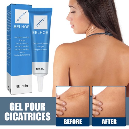 EELHOE Scar Repair Gel External Cold Compress Cream Skin Damage Repair Type Softens, Smoothes and Moisturizes Scars