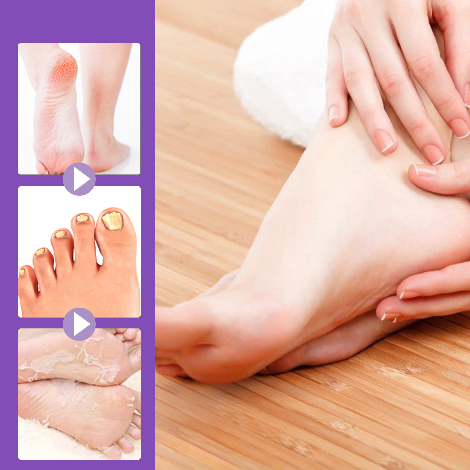 EELHOE Ginger Foot Mask for Dry Cracked Skin, Exfoliating, Dead Skin Removal, Moisturizing, Nourishing Foot Care Mask