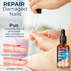ToenailPlusは甲溝に抵抗して油を緩和します。