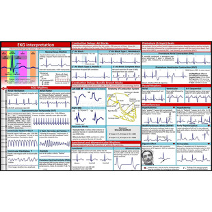 Cross-border New EKGPocketGuide ECG Pocket Guide ECG Information Medical Professionals