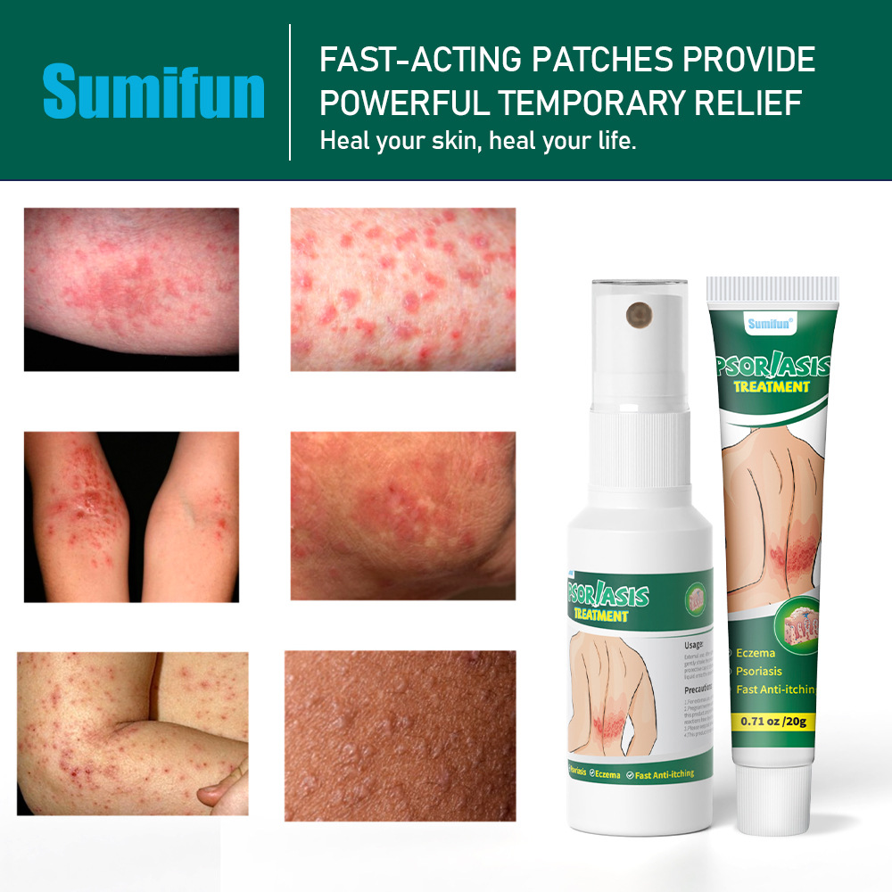 Sumifun tinea skin care set with anti acne spray and skincare cream K50015_voghion.com
