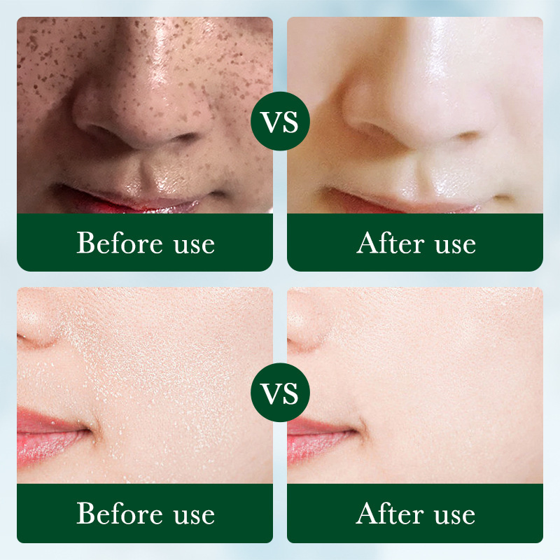 Lotion hydratante éclaircissante nourrissante réparatrice à la réglisse SADOER VC_voghion.com