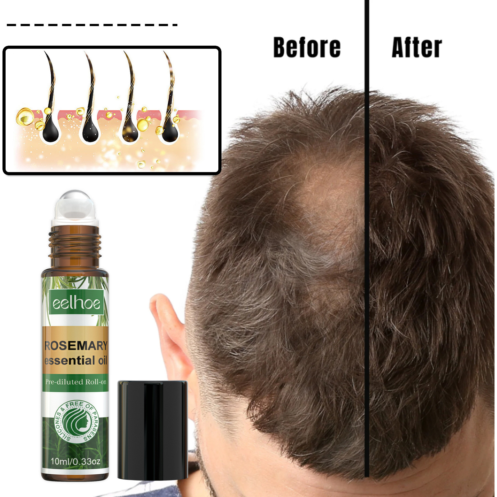 EELHOE Rosemary Hair Roller Ball Couro Cabeludo Limpeza Massagem Cuidados Raízes do Cabelo Forte Hidratação Linha do Cabelo Grossa_voghion.com