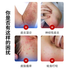 川井弘岩皮膚濕癢型醫用退熱凝膠20g 皮炎濕診瘙癢不適塗抹膏批發