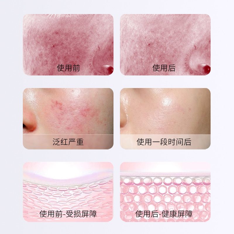 依克多はクリームを修復して角質層を厚くして皮脂膜の季節を変えて敏感な肌を改善します。|undefined