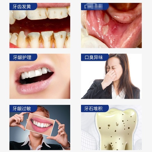 Helicobacter pylori mouthwash oral cleaning care bad breath gargle 200ml fresh breath unisex