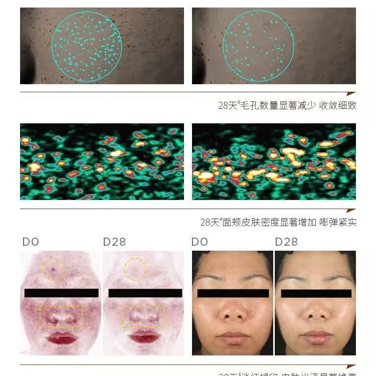 胺肌修护霜舒缓补水保湿霜修护屏障敏感肌紧致美白滋润美容院专供|undefined
