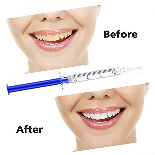 Teeth Whitening Device